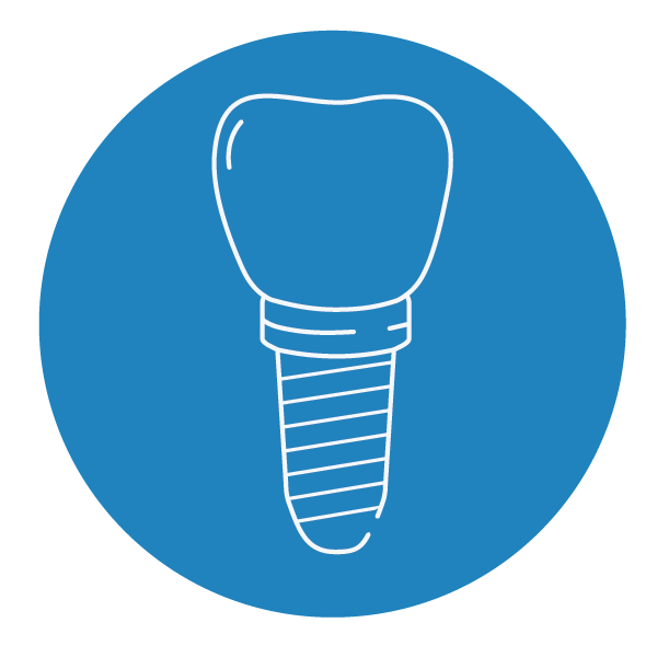 Dental Implant Restorations Pittman Dental Laboratory